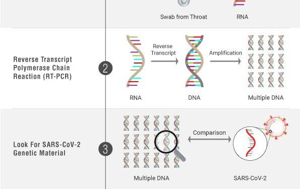 U Rwanda rumaze gufata ibipimo bya Coronavirus birenga miliyoni mu mezi 12
