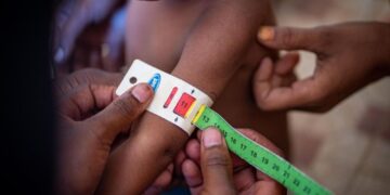 Umugore wagwingiye aba afite ibyago byo kubyara umwana ugwingiye